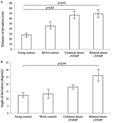 Vestibular Loss in Older Adults Is Associated with Impaired Spatial Navigation: Data from the Triangle Completion Task